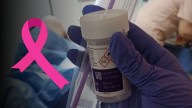 Inicia campaña de prevención de cáncer cervicouterino en Durango