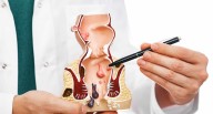 Cáncer de colon: mitos peligrosos que retrasan el diagnóstico y ponen en riesgo la vida