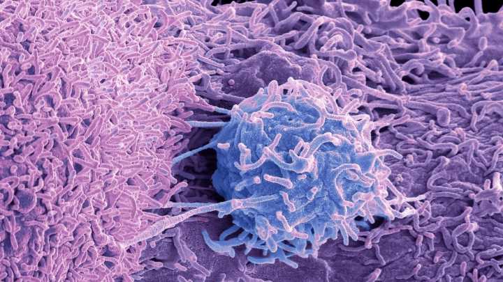 The 9 early warning signs of cancer no man should ever ignore - from back pain to peeing in the night