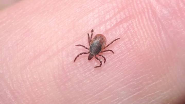 What is Lyme disease? Local doctors explain
