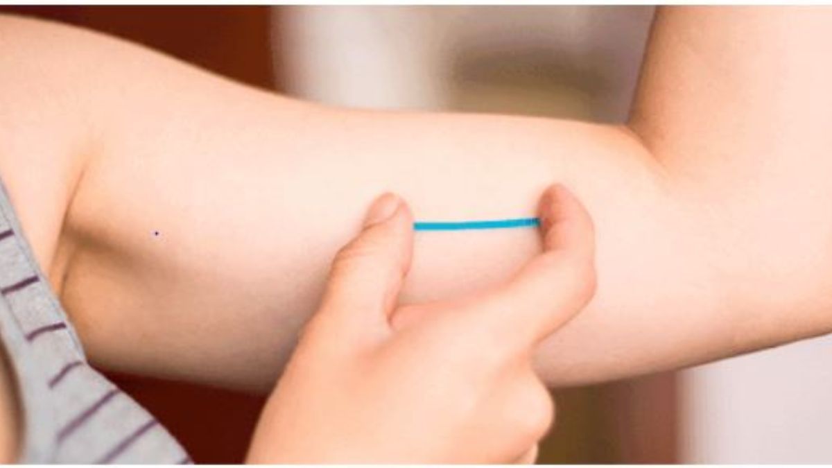 Tres de cada 10 adolescentes mendocinas utilizan anticonceptivos de larga duración