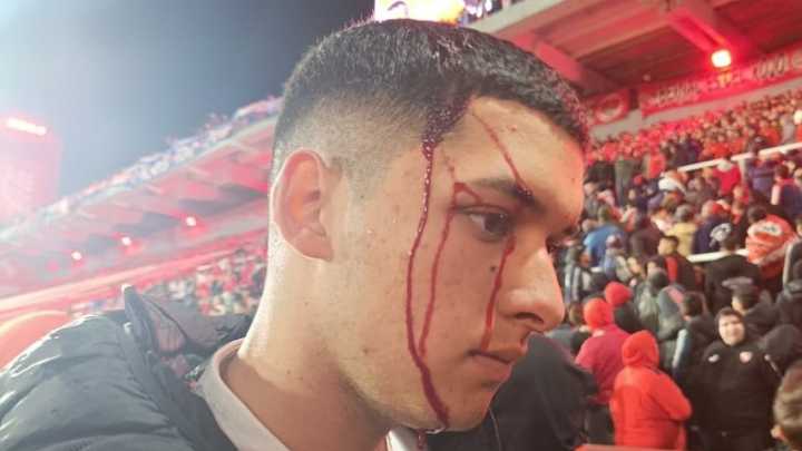Independiente vs. U de Chile: suspendido tras enfrentamientos y heridos El Rojo y la U empataban 1 a 1 por el partido de vuelta de los octavos de final de la Copa Sudamericana en un duelo que no termi