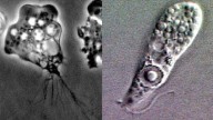 Brain eating amoeba case in Missouri: What is Naegleria fowleri?