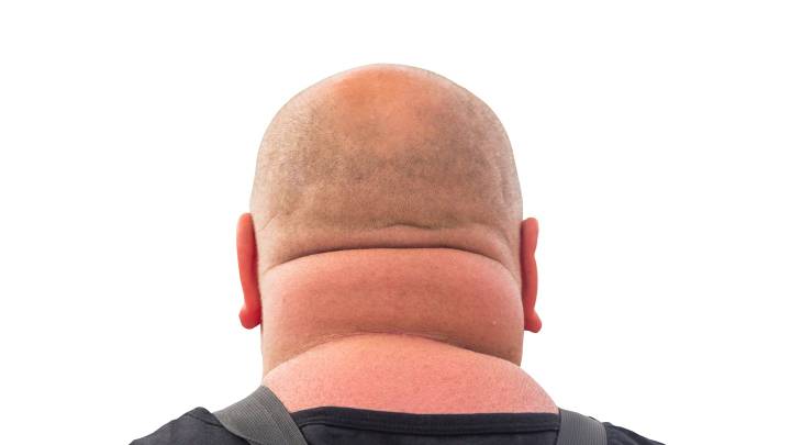 What your neck size reveals about your health