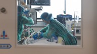 Pros and cons of universal health care in the United States
