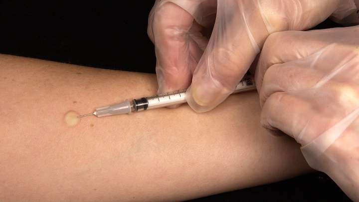 Tuberculosis reported in WNC: What residents should know…