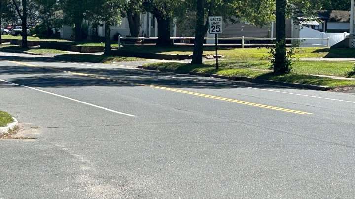 Man has severe injuries after being struck by car in East Hartford: police