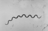 3 babies have died of congenital syphilis in New York: What is it?