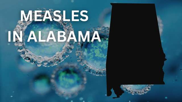 Alabama confirms first measles case since 2002 in unvaccinated child