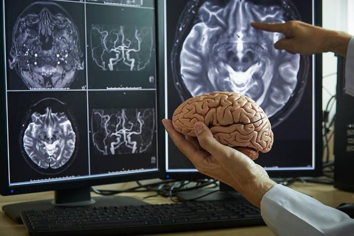 Talk Therapy Alters Brain Structure, MRI Scans Show