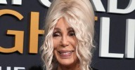 Cher's Plastic Surgery Nightmare Leaves Her With Clown