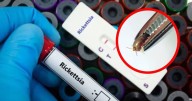 Preocupa el incremento en casos de rickettsia