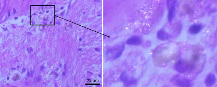 Microplastics Are Infiltrating Your Brain. What Are The Effects?