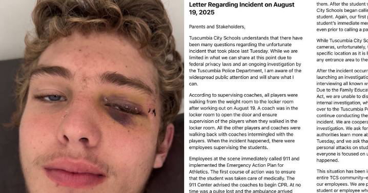 Tuscumbia City Schools sends letter to parents claiming it 'immediately launched' investigation into August Borden's injuries