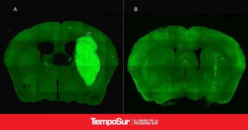 Nuevo Especialistas del CONICET lograron frenar un tipo de cáncer cerebral con una novedosa estrategia terapéutica