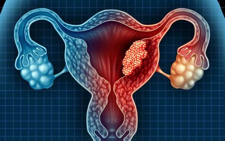 How Tamoxifen Raises Uterine Cancer Risk—and a Path to Prevention