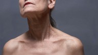 FDA Panel Seeks More Data on Filler Use in Decolletage Area