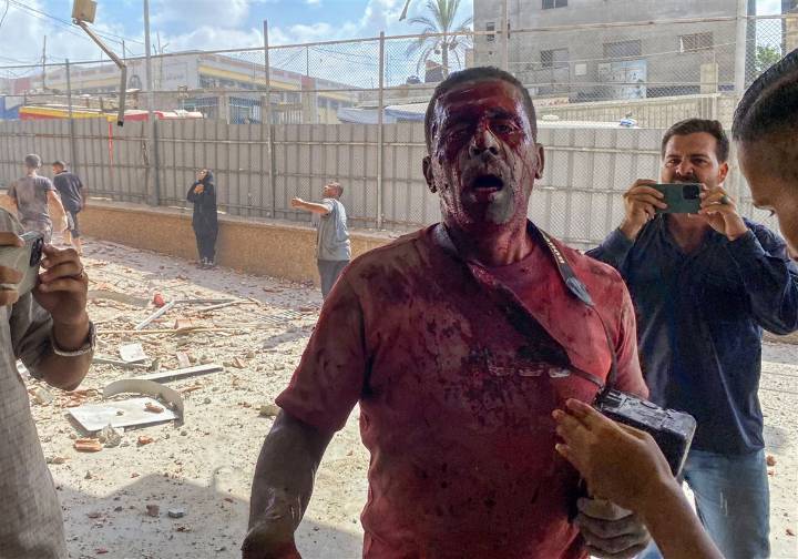Israeli airstrike on southern Gaza hospital kills 19, hospital says