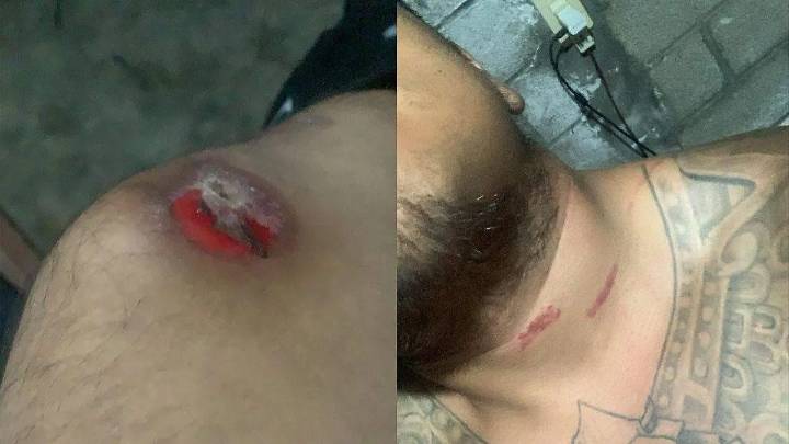 Tehuacanero acusa violencia de marinos durante revisión