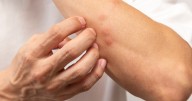 Health bosses issue warning as deadly Oropouche virus with 'severe consequences' found in UK for first time