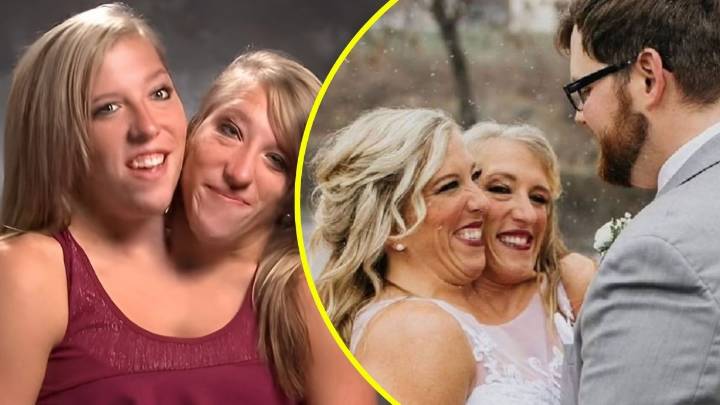 Famosas hermanas siamesas fueron captadas con un bebé y despiertan rumores de maternidad: Una de ellas está casada