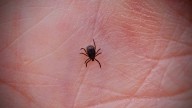 New invasive tick could bring a little-known, debilitating infection – NBC Bay Area