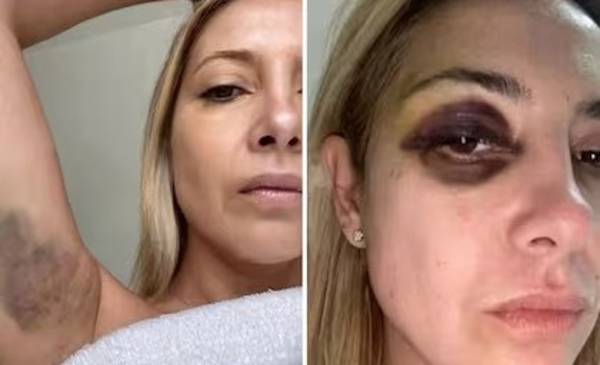 Piden que Alberto Fernández vaya a juicio por violencia de género contra Fabiola Yáñez