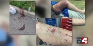 Loose pit bulls tear into elderly man in Forest Park, police still searching for owner