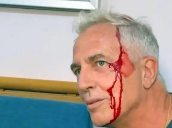 Marley se accidentó en Tailandia y terminó bañado en sangre durante “Por el Mundo”