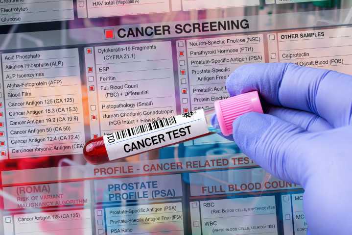 Exámenes médicos gratuitos para hombres en septiembre