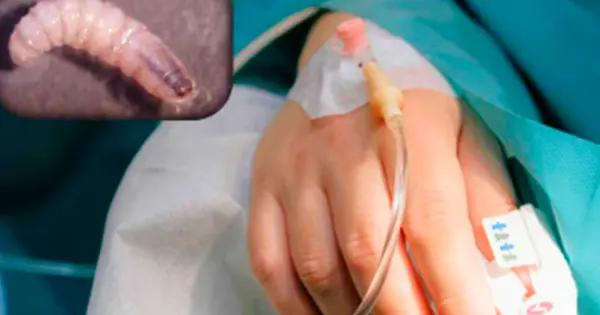 Detectan primera persona infectada con gusano barrenador en Yucatán