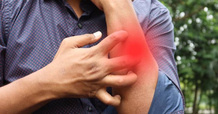 ¿Cómo saber si padeces psoriasis? Una enfermedad muy común y poco diagnosticada