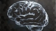 Un neurólogo señala el alimento al que debes prestar atención para no dañar tu cerebro: puede causar parálisis o visión borrosa