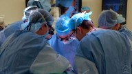 Primer trasplante de pulmón de cerdo a un humano en muerte cerebral