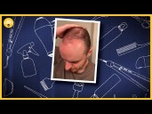 'From Thinning to Winning' explores natural remedies for hair growth