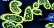 Desarrollan un antiviral con potencial para convertirse en el primero de amplio espectro del mundo