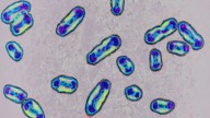 California resident tests positive for plague