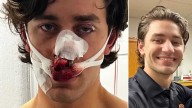 Heroic Colonie Paramedic, Model Stabbed While Saving Women From Attackers In Germany