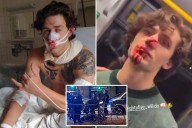 Syrian migrant arrested for slashing American model John Rudat across the face