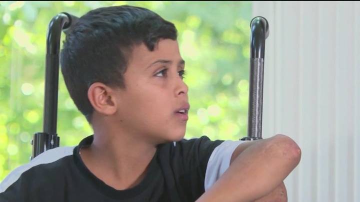 Boy from Gaza comes to Atlanta, begins treatment after losing legs in the war