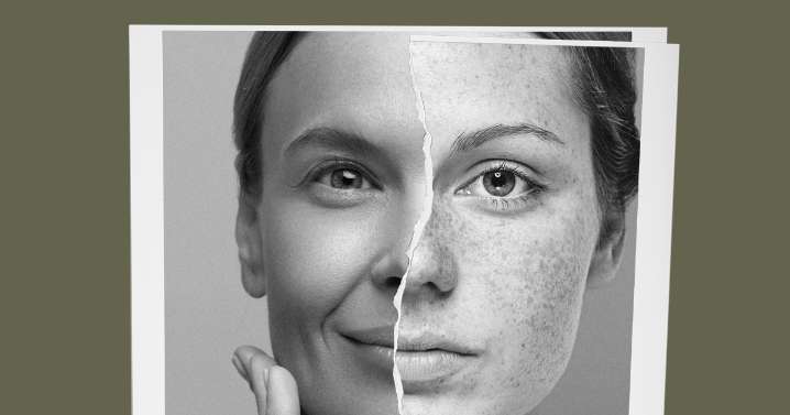The Rise of Faux Freckles: Have We Lost the Plot?