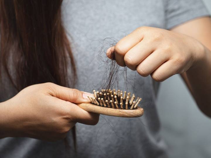 Señales de alopecia y qué puedes hacer para frenarla