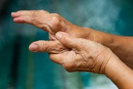 Benefits of Long-Term Routine Lab Drug Toxicity Monitoring Unclear in RA