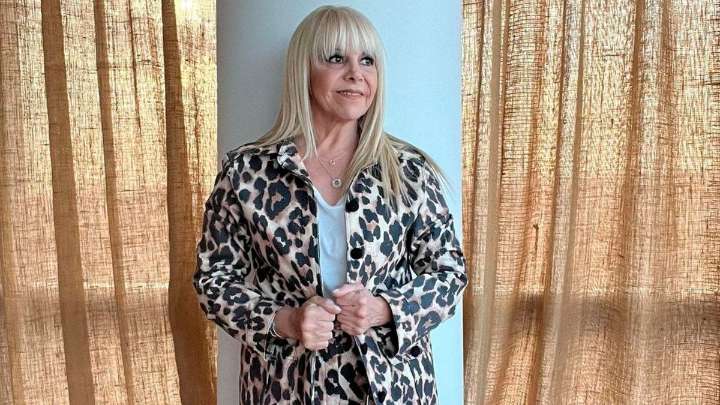 Chocó Claudia Villafañe: sufrió un leve trauma de cráneo