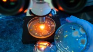 La bacteria "come carne" se encuentra en estos lugares: lo que debes saber para protegerte