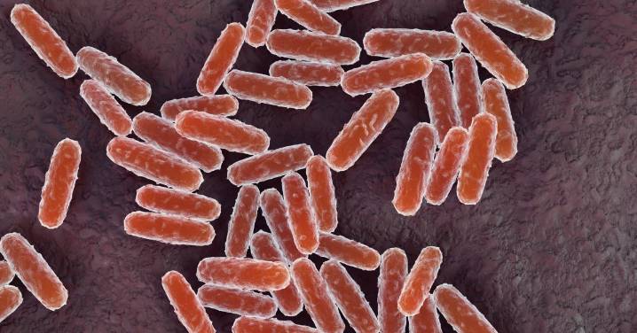 A California Resident Has Plague