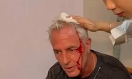 Marley sufrió un fuerte accidente en Tailandia