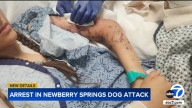 Dog attack: San Bernardino County man arrested after teen mauled by dogs