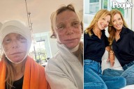 Identical Twins Get Identical Facelifts Hours Apart. Then Came the Challenging Recovery (Exclusive)