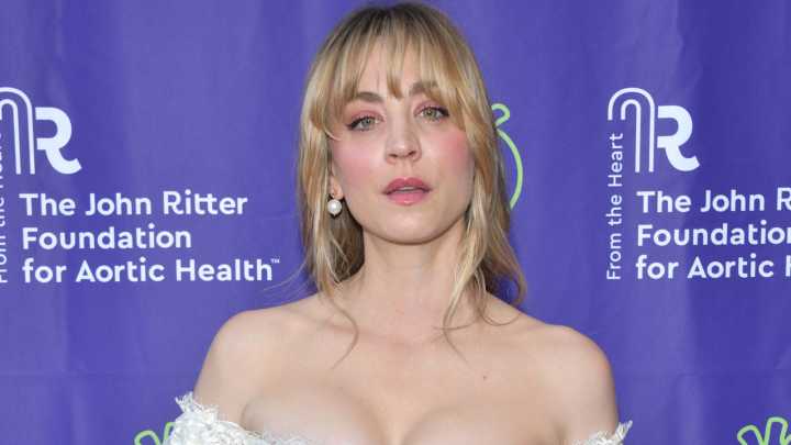 Kaley Cuoco Has Been Open About Her Plastic Surgery For A Long Time